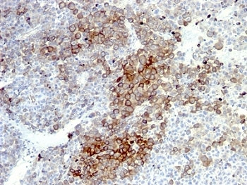 NGF Receptor Antibody Cocktail