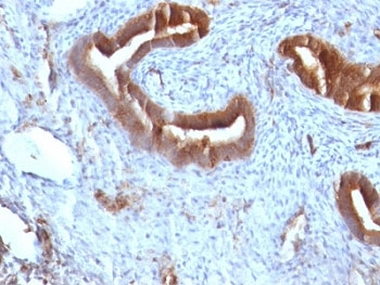 Beta-2 Microglobulin Antibody