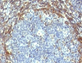 Bcl2 Antibody