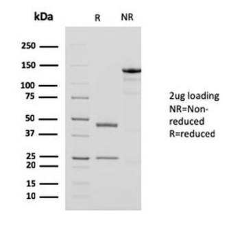 ACTA2 Antibody Cocktail / Alpha Actin