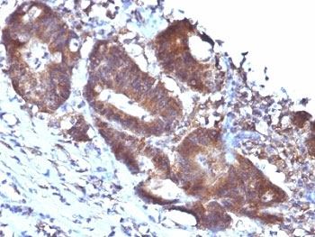 SM22 Antibody