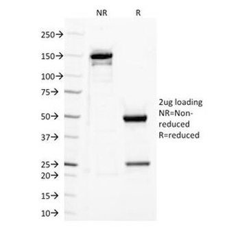 TLR2 Antibody / Toll Like Receptor 2