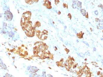 TNF-a Antibody