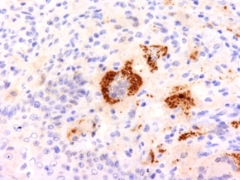 TNF-a Antibody
