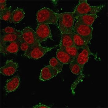 TNF-a Antibody