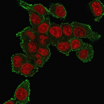TNFa Antibody
