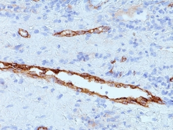 vWF Antibody