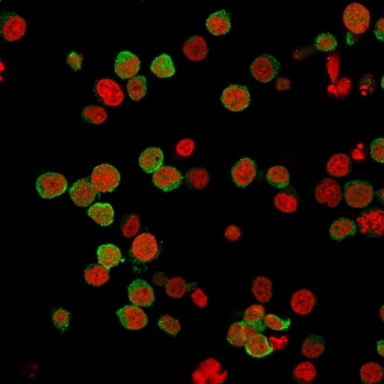 ZAP-70 Antibody