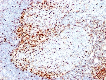 ZAP-70 Antibody