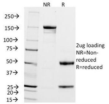 ZAP-70 Antibody