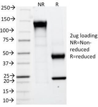 CAIX Antibody / Carbonic anhydrase IX
