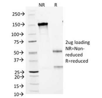 CD1a Antibody