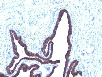 Cytokeratin 8/18 Antibody Cocktail