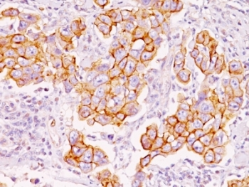 Phosphotyrosine Antibody (p-Tyr)