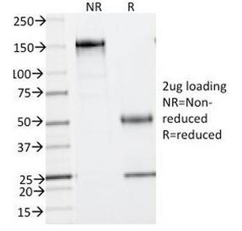 Phosphotyrosine Antibody (p-Tyr)