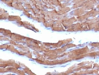 Pan Muscle Actin Antibody