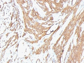 Pan Muscle Actin Antibody Cocktail