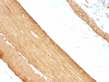 Pan Muscle Actin Antibody Cocktail