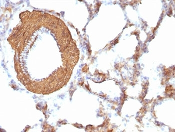 Pan Muscle Actin Antibody Cocktail