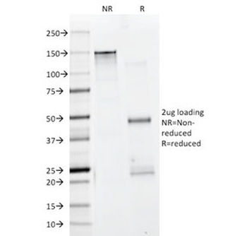 Pan Muscle Actin Antibody Cocktail