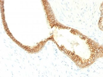 E-Cadherin Antibody / CDH1