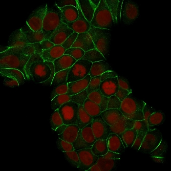 E-Cadherin Antibody / CDH1