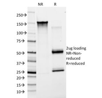 von Willebrand Factor Antibody