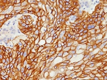 EGF Receptor Antibody