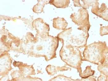 EGF Receptor Antibody