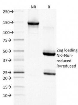 EGF Receptor Antibody
