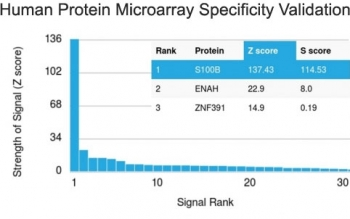 Recombinant S100B Antibody / Rabbit Monoclonal