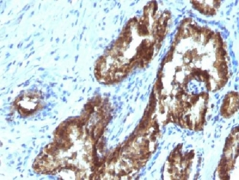 TDP2 Antibody / Tyrosyl-DNA phosphodiesterase 2 / ETS1 associated protein II