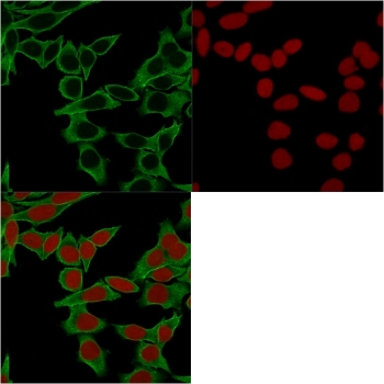 Spectrin beta III Antibody / SPTBN2