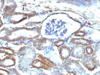Spectrin beta III Antibody / SPTBN2