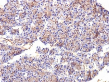 Spectrin beta III Antibody / SPTBN2