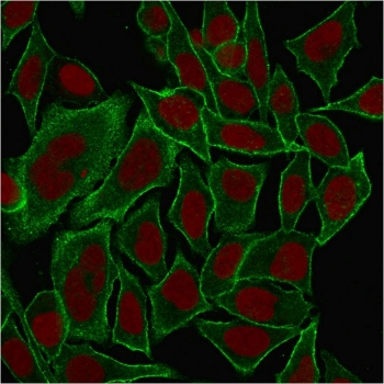 Spectrin beta III Antibody / SPTBN2