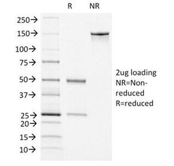 vWF Antibody