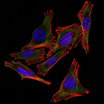 S100B Antibody