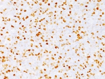 TOP2A Antibody / Topoisomerase II alpha