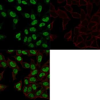 TOP2A Antibody / Topoisomerase II alpha
