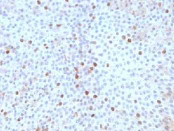 Topoisomerase II alpha Antibody / TOP2A
