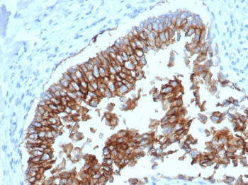 Ep-CAM Antibody