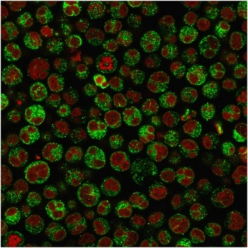 Recombinant CD79a Antibody / Rabbit Monoclonal
