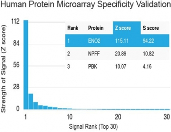 Neuron Specific Enolase Antibody / NSE
