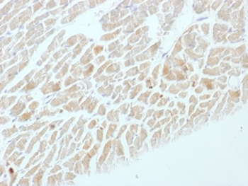 Neuron Specific Enolase Antibody / NSE