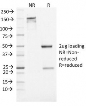 Neuron Specific Enolase Antibody / NSE