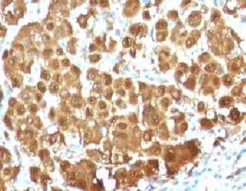 S100 beta Antibody