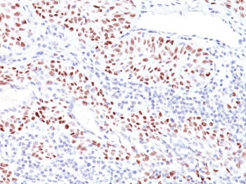 TP53 Antibody