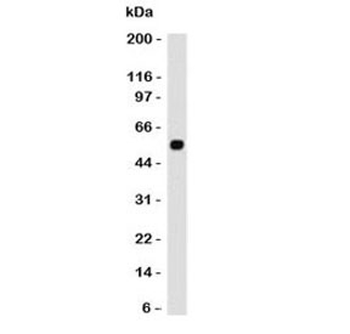 p53 Antibody
