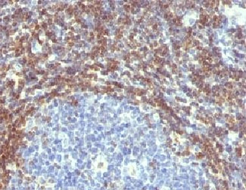 Bcl2 Antibody